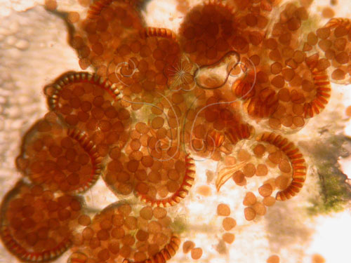 取下成熟的孢子囊放置於载玻片,接著用显微镜观察,便能看见孢子囊柄